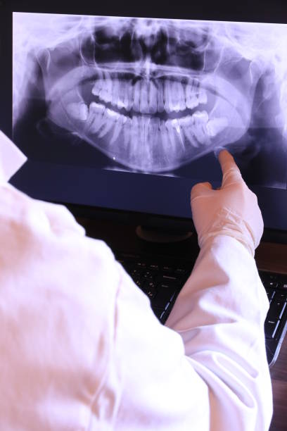 Best Emergency Treatment for Dental Infections or Abscesses in New Madison, OH